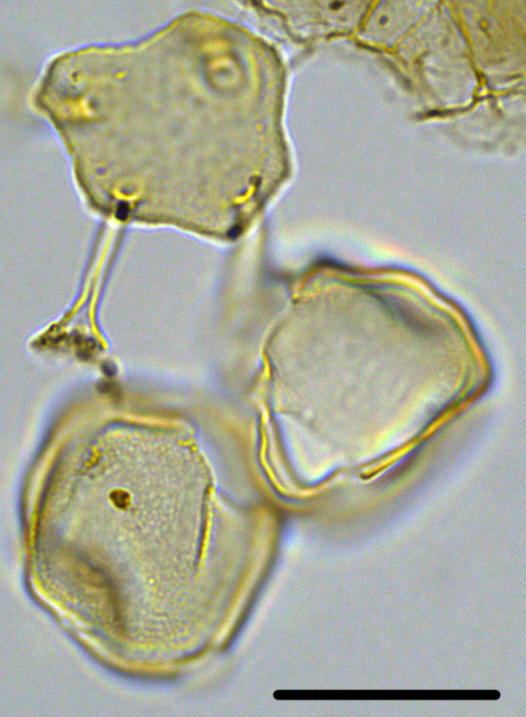 Batiacasphaera obohikuenobe Boboh cluster + Hyst. tubiferum operculum 27X20304128973.jpg